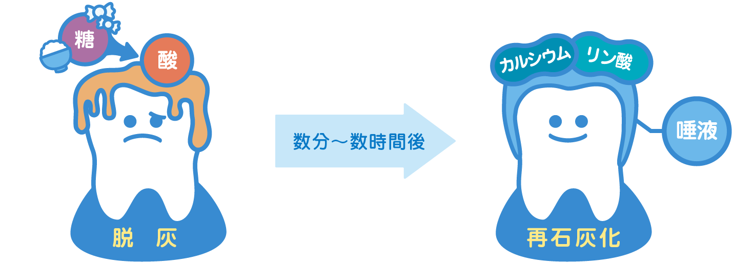 脱会から再石灰化