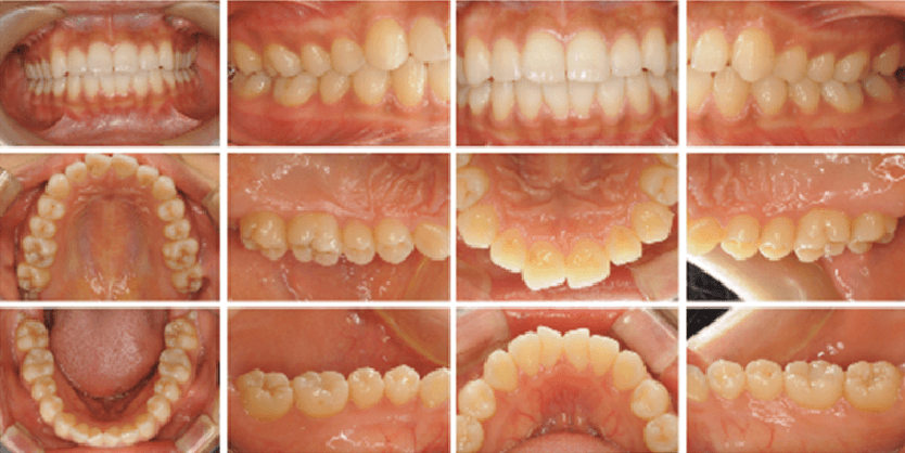 口腔内全体のカラー写真